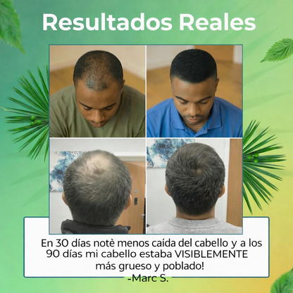 BLOCKER DHT Bloquea el DHT aportando nutrientes clinicos para el crecimiento veloz del cabello