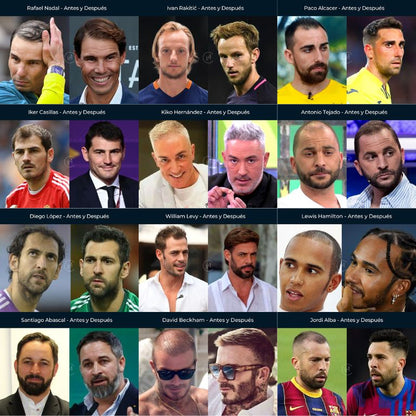 BLOCKER DHT Bloquea el DHT aportando nutrientes clinicos para el crecimiento veloz del cabello