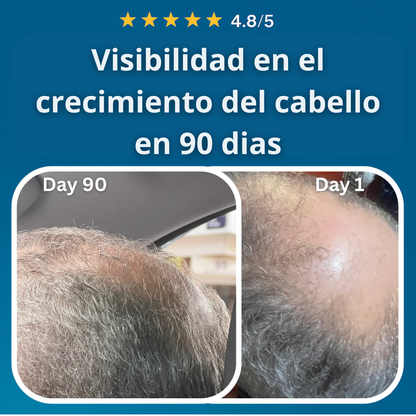 FolixDerm - Bloquea el DHT y activa el crecimeinto del cabello